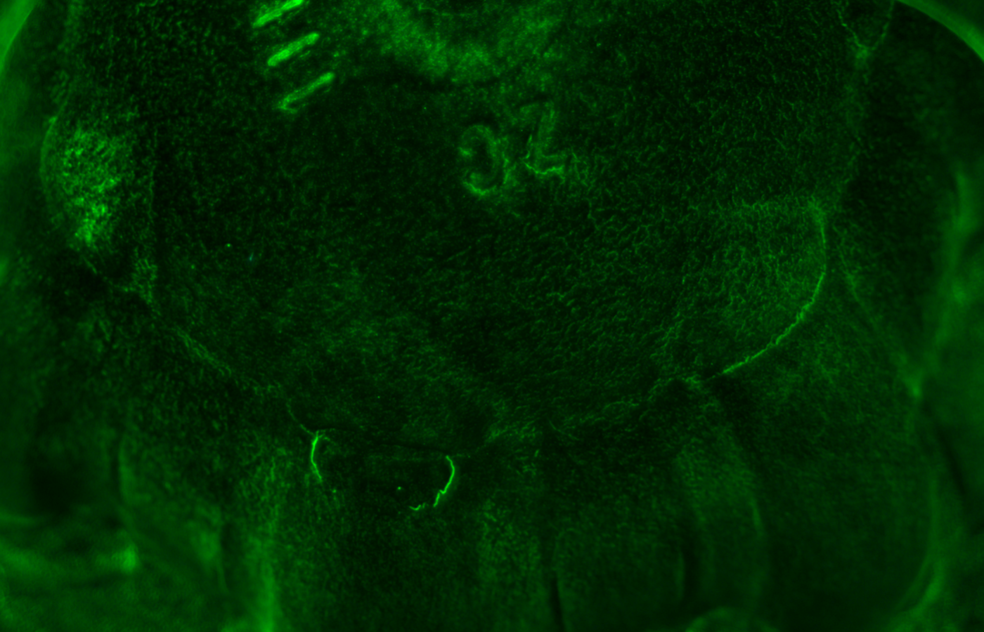 Inner side NG defect 2