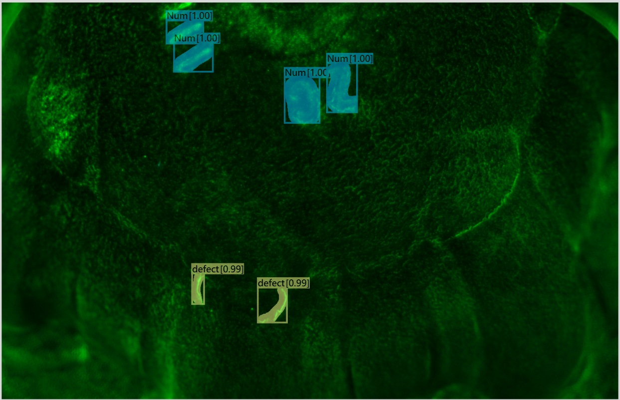 Inner side iEagleAI detected 2